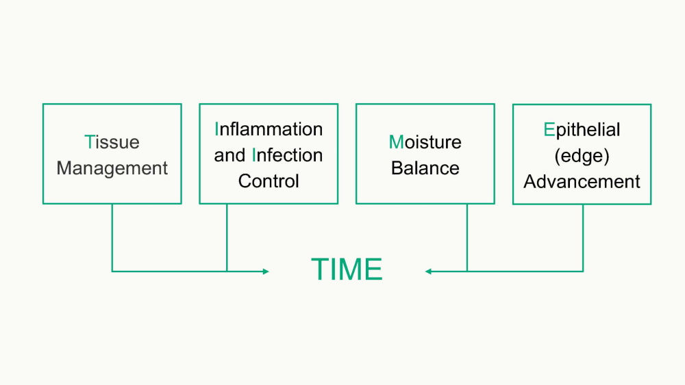 gráfico del concepto de tiempo