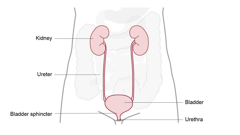 ilustración de urostomía