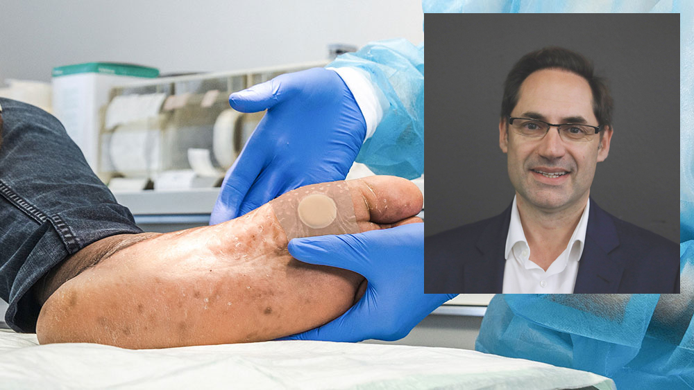 Dos profesionales sanitarios asistiendo a una sesión digital sobre infecciones por úlceras del pie diabético