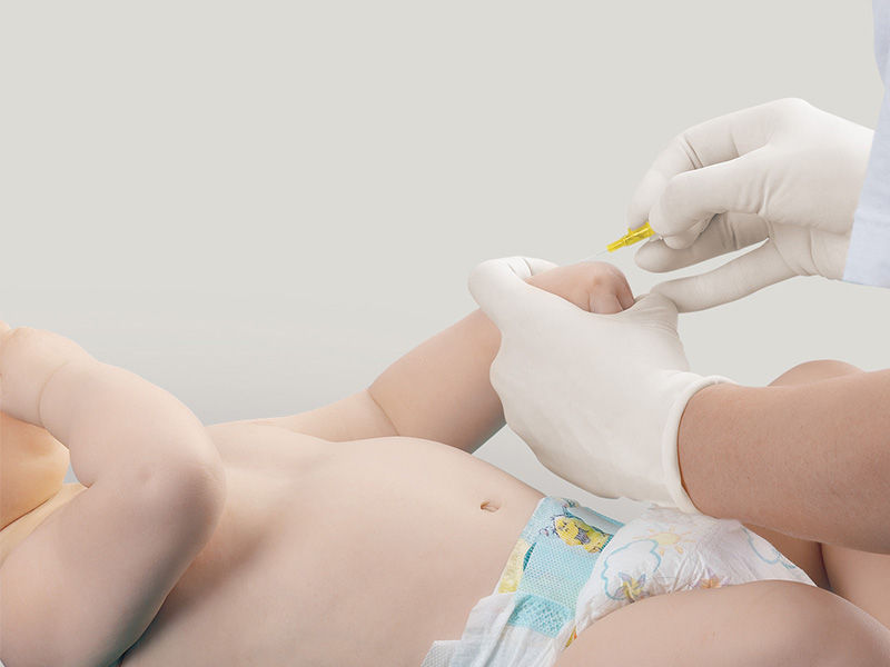 Bebé tumbado en pañales. El brazo izquierdo se sujeta a la muñeca con una mano con guantes. Una mano derecha con guantes sujeta una cánula amarilla Introcan Safety®. La punta de la cánula apunta hacia el punto de punción.