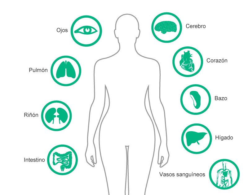 Parts and organs of the human body mainly affected by particulate contamination of IV fluids: Eye, Lung, Kidney, Intestine, Brain, Heart, Spleen, Liver, Blood Vessels.