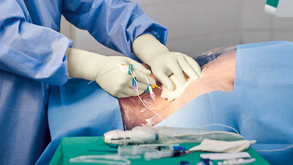 Colocación de un catéter central insertado centralmente en un campo estéril, incluidos los componentes y el equipo.